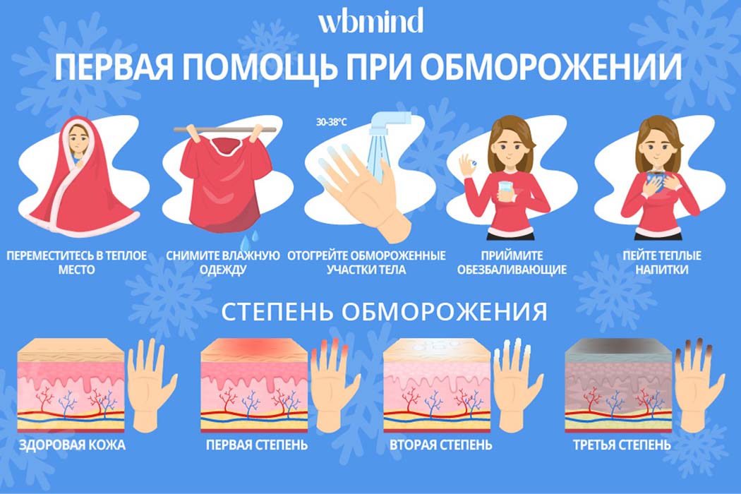 Обморожение: первая помощь