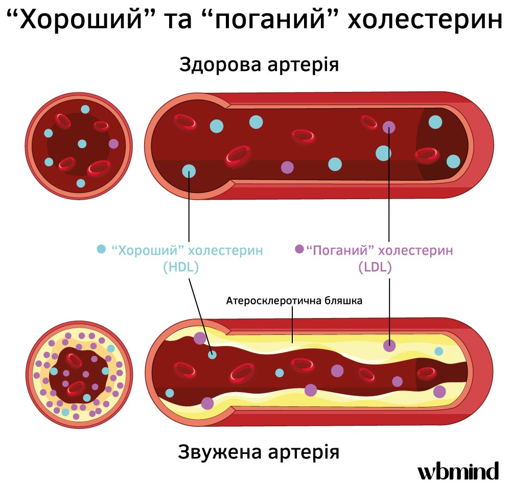 Хороший та поганий холестерин