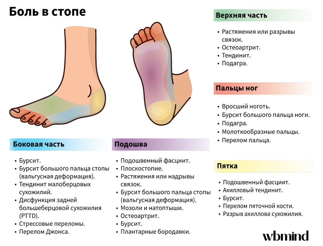 Боль в стопах: причины